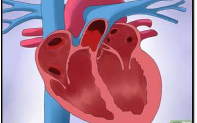 Actualización en Insuficiencia Cardiaca